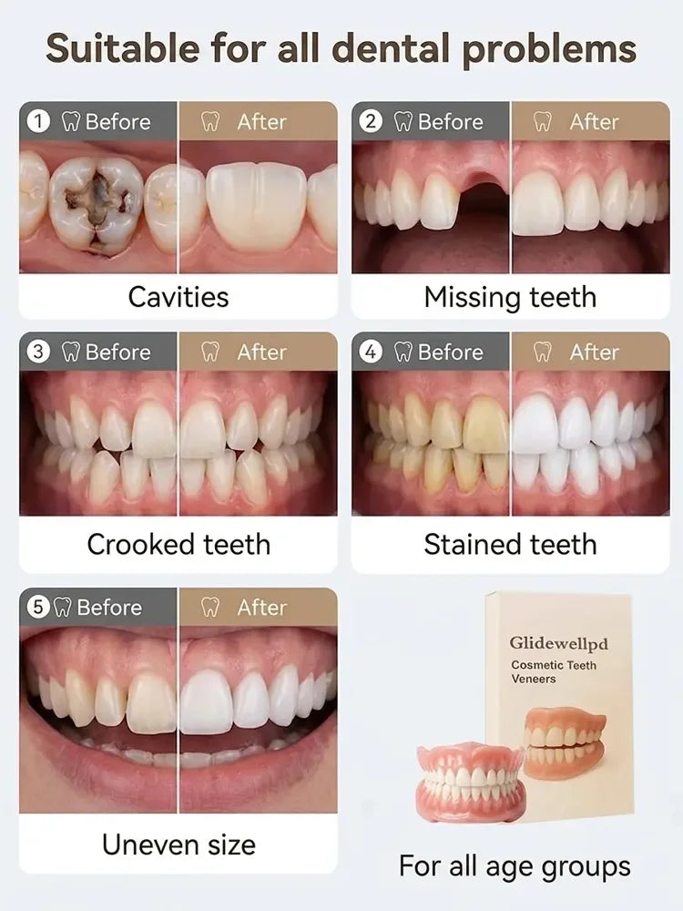 💥LAST DAY 50% OFF! Custom-Fit Instant Smile Dentures – Ultra Natural Appearance, Custom Comfort Fit You’ll Love